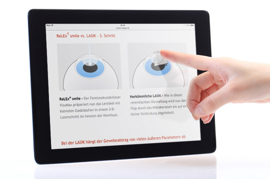 iPad mit Illustrationen zu SMILE und LASIK mit einer Hand, die auf den Flap zeigt