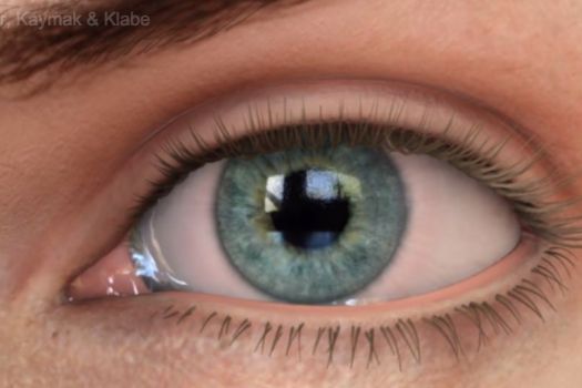 Teaserbild [Echo] Blepharitis Auswirkungen und Ursachen