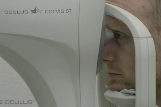 Teaserbild [Vimeo] Augen-Vorsorge mit dem Non-Contact-Tonometer Corvis ST der Fa. Oculus